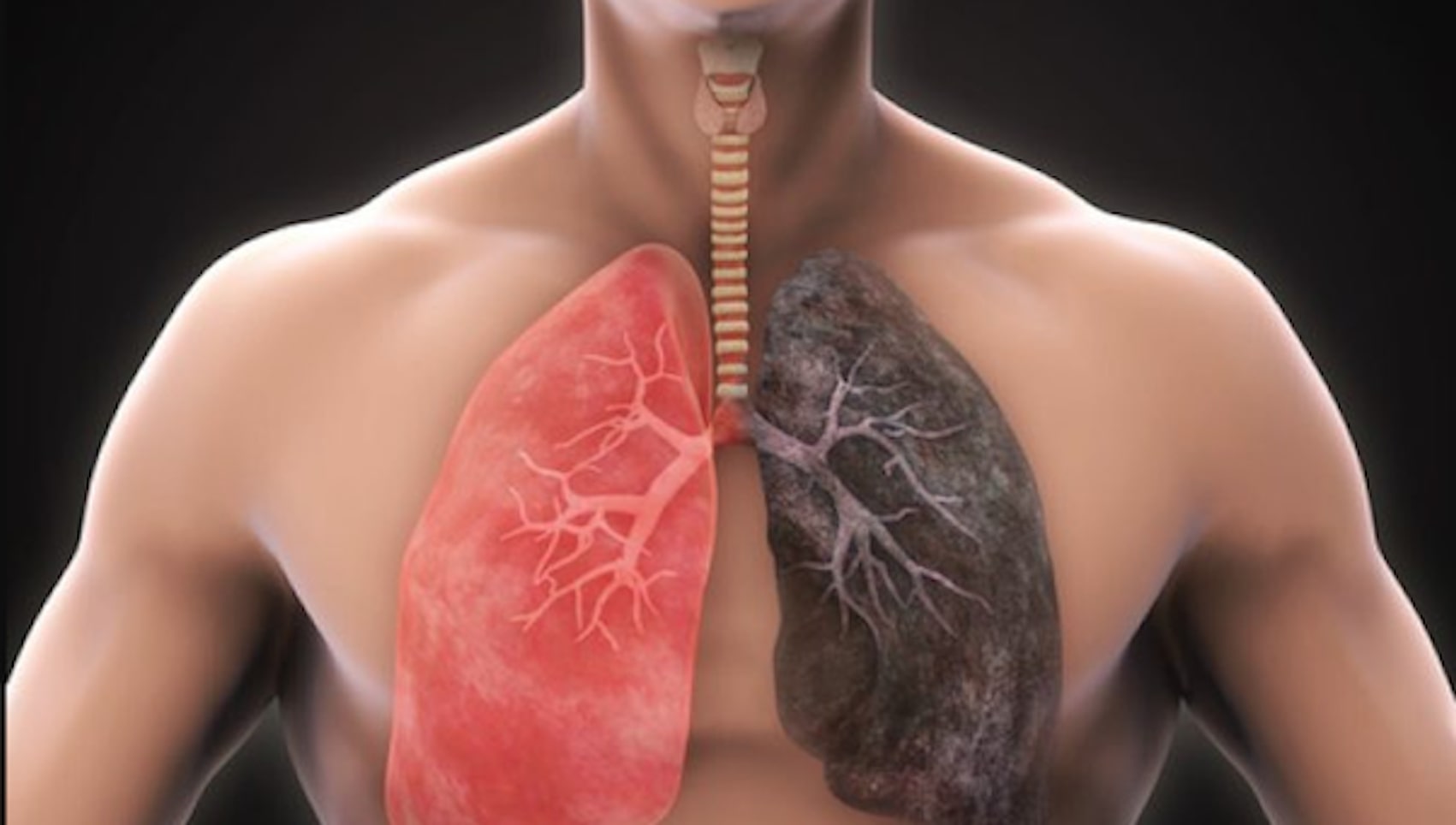 ILD Doctor in Bilaspur Chhattisgarh